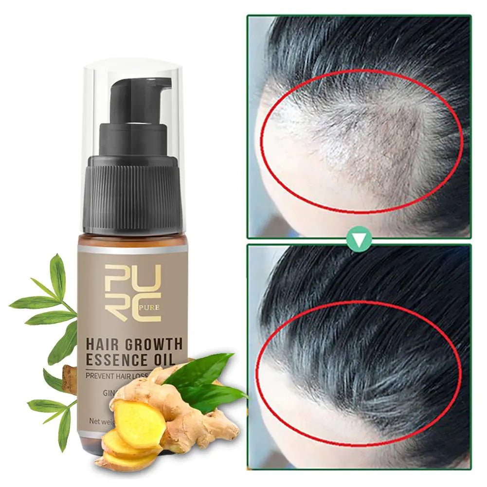 Beneficios sérum PURC crecimiento capilar acelerado